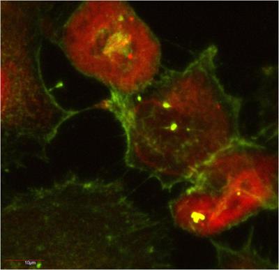 Mechanisms of tunneling nanotube-based propagation of neurodegenerative disease proteins